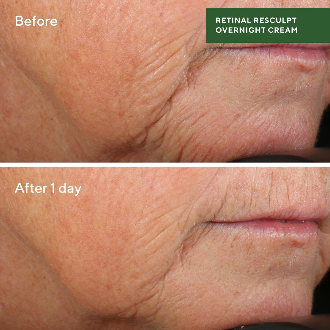 Retinal Resculpt Overnight Cream