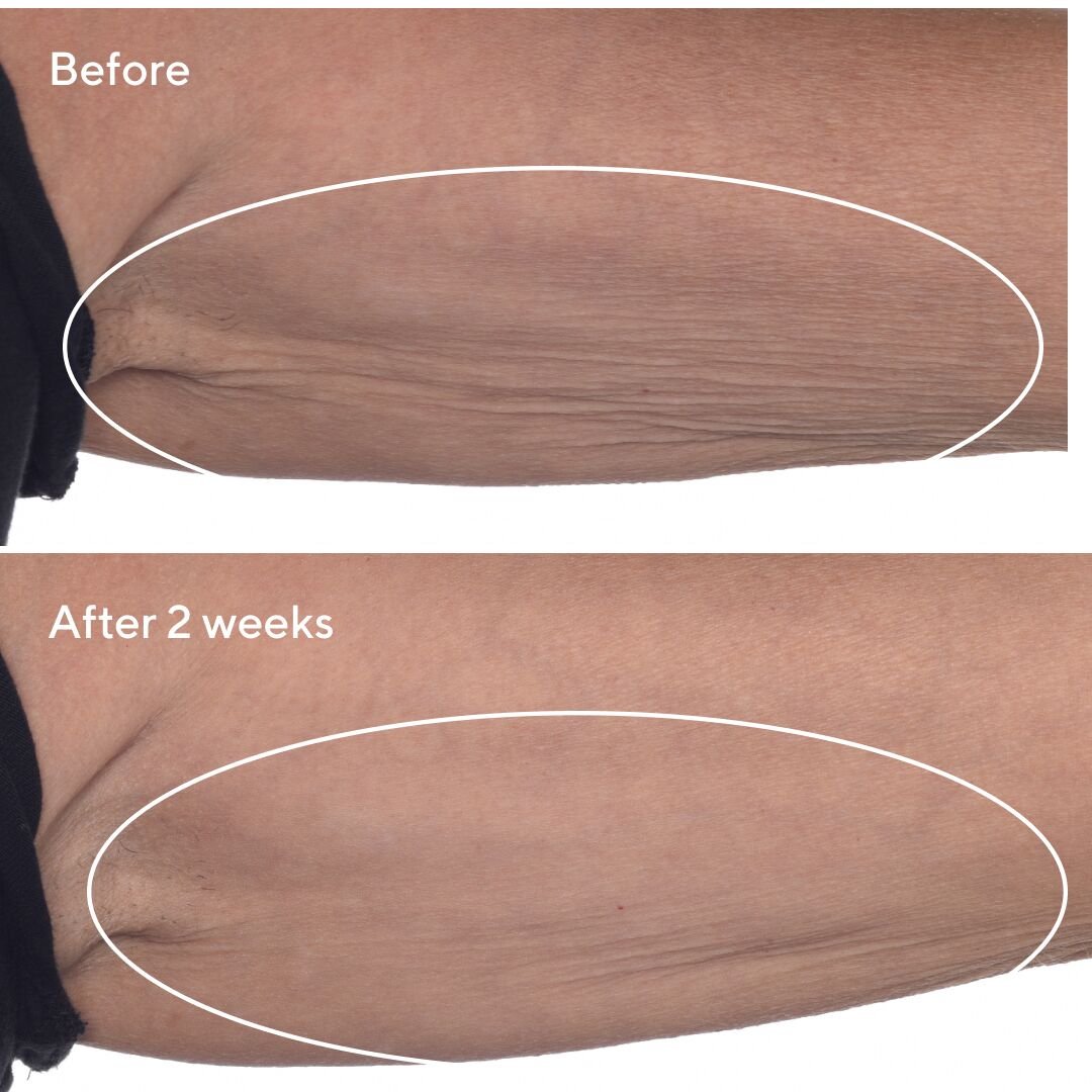 Retinal Resculpt Body treatment 148ml - Image 4